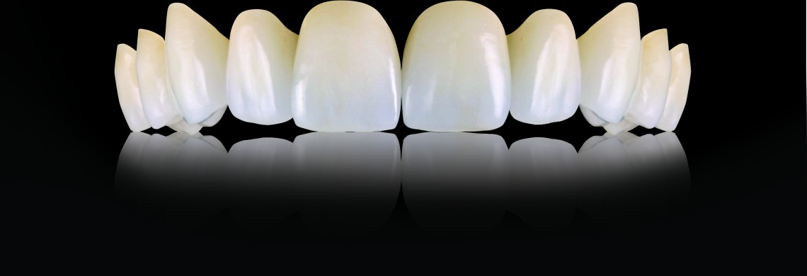 Oral-Art_Oral-Arts-Dental-Laboratories---IPS-emax-Crowns_67211